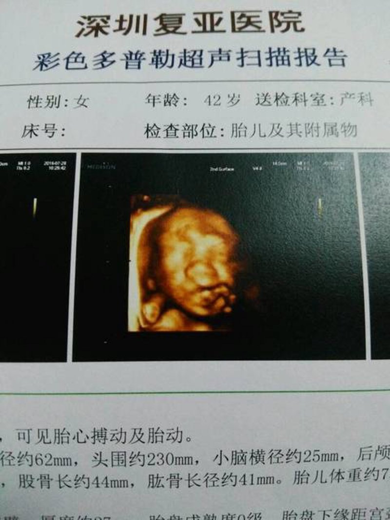 深圳人流医院：选择安心的医疗环境